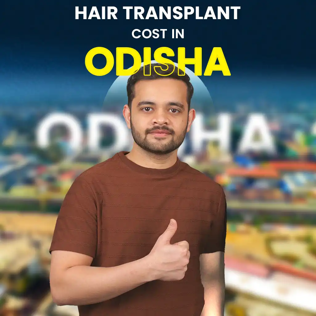 Hair Transplant Cost in odiha
