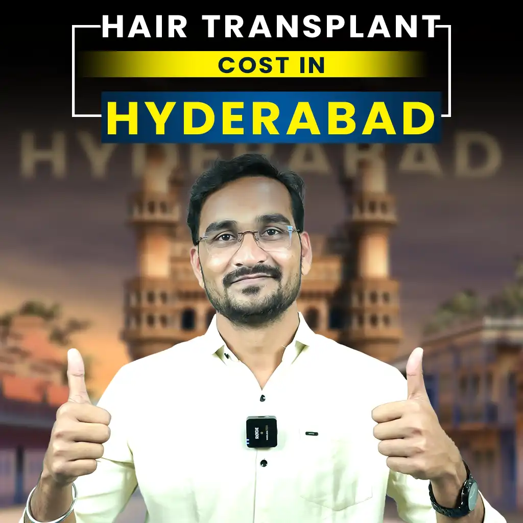 Hair Transplant cost of hyderabad