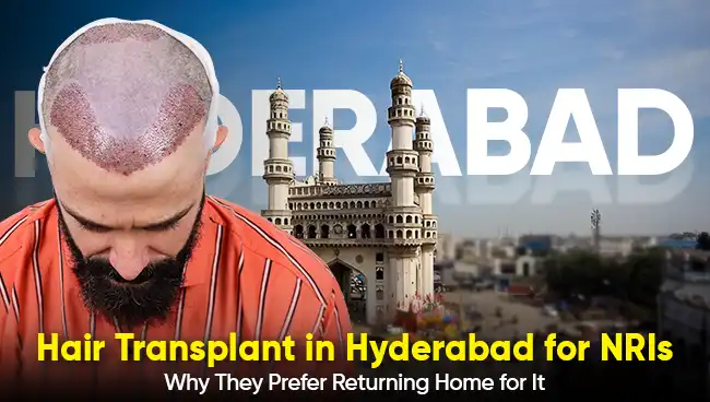 this info graphic shows how we are first choice from NRIs for hair transplant in Hyderabad with Hairfree & Hairgrow clinic