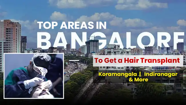 This info graphic shows how Hairfree & Hairgrow is best hair transplant in bangalore top areas.