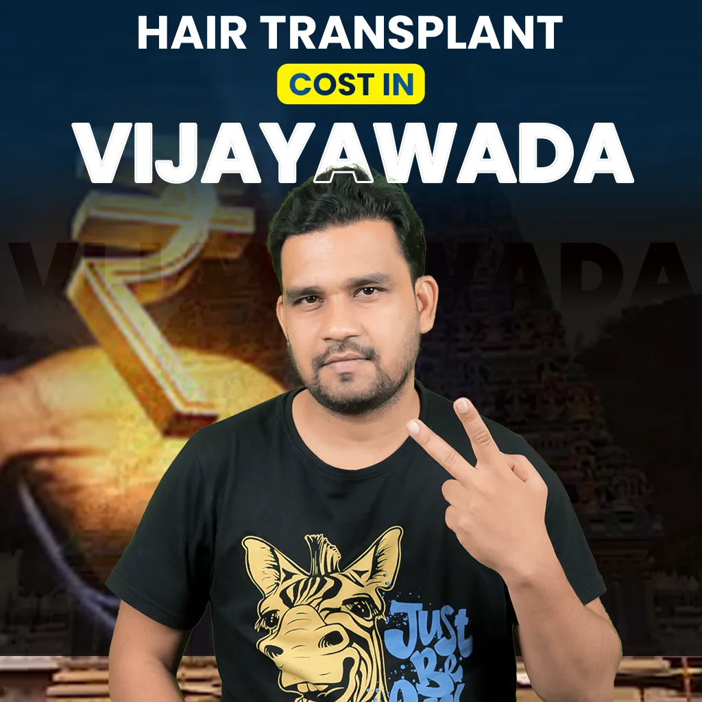 hair transplant cost in vijaywada detailed