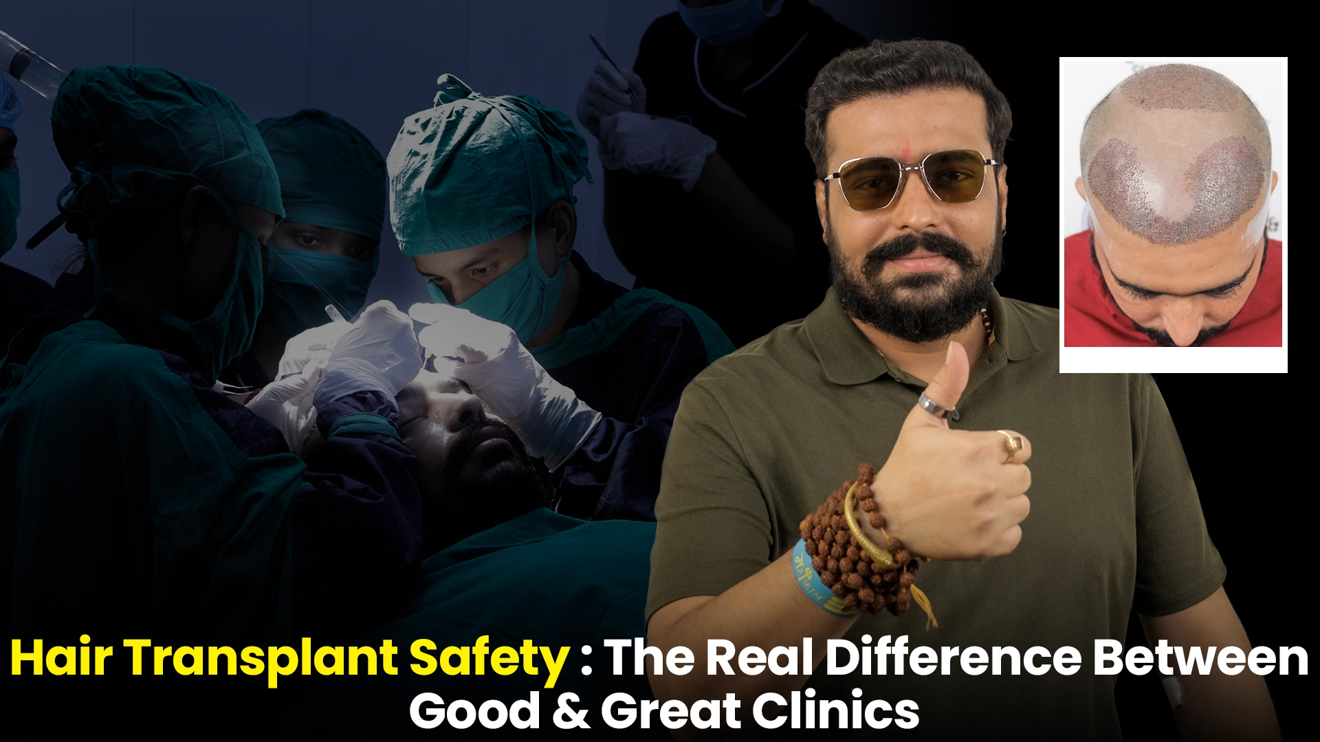 Hair Transplant Safety during surgery and patient results