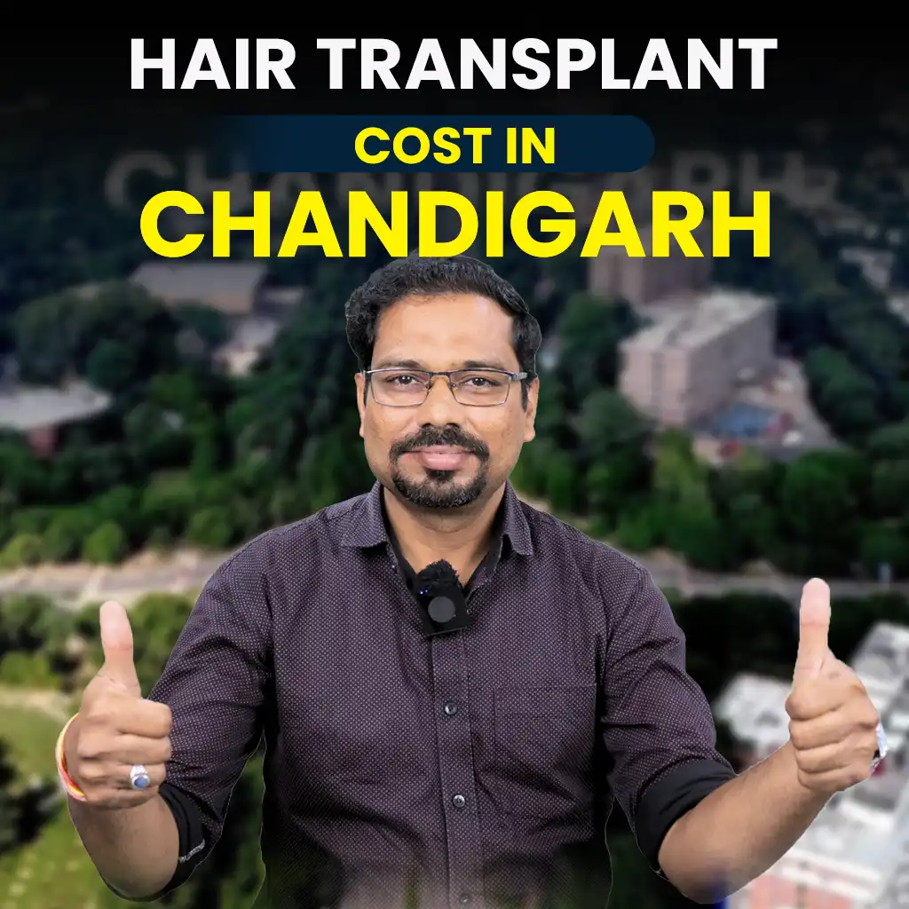 Hair Transplant Cost in Chandigarh 6 hair transplant cost in Chandigarh detailed