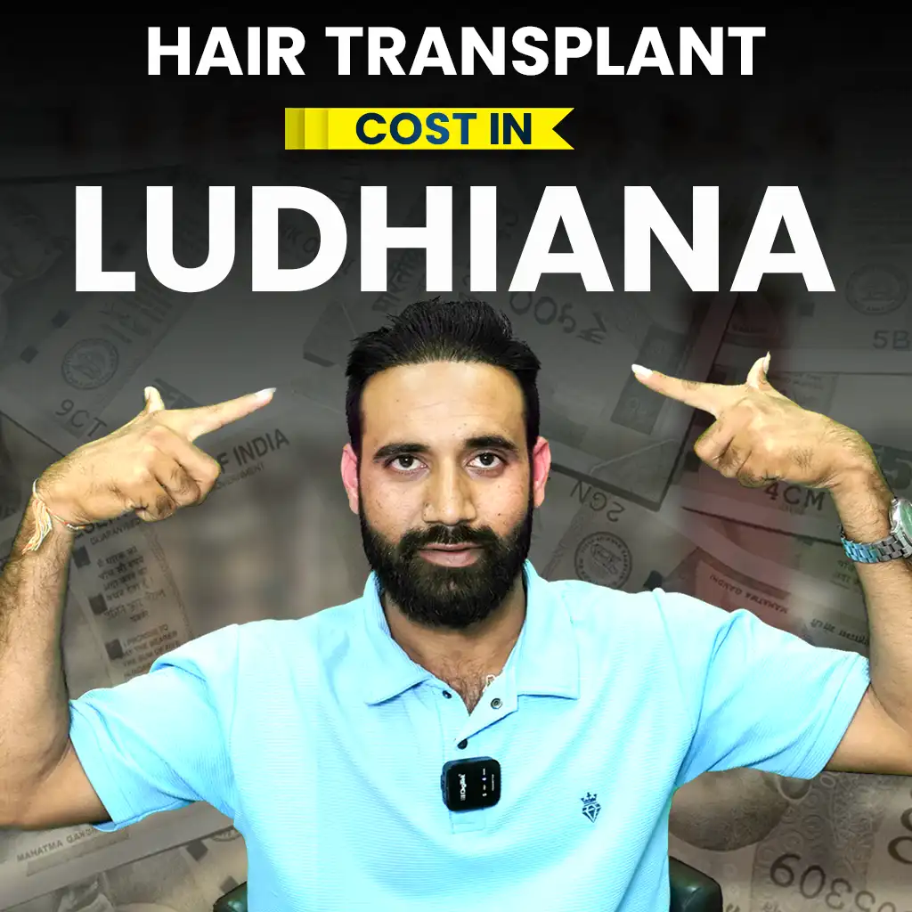 hair transplant cost in Ludhiana detailed