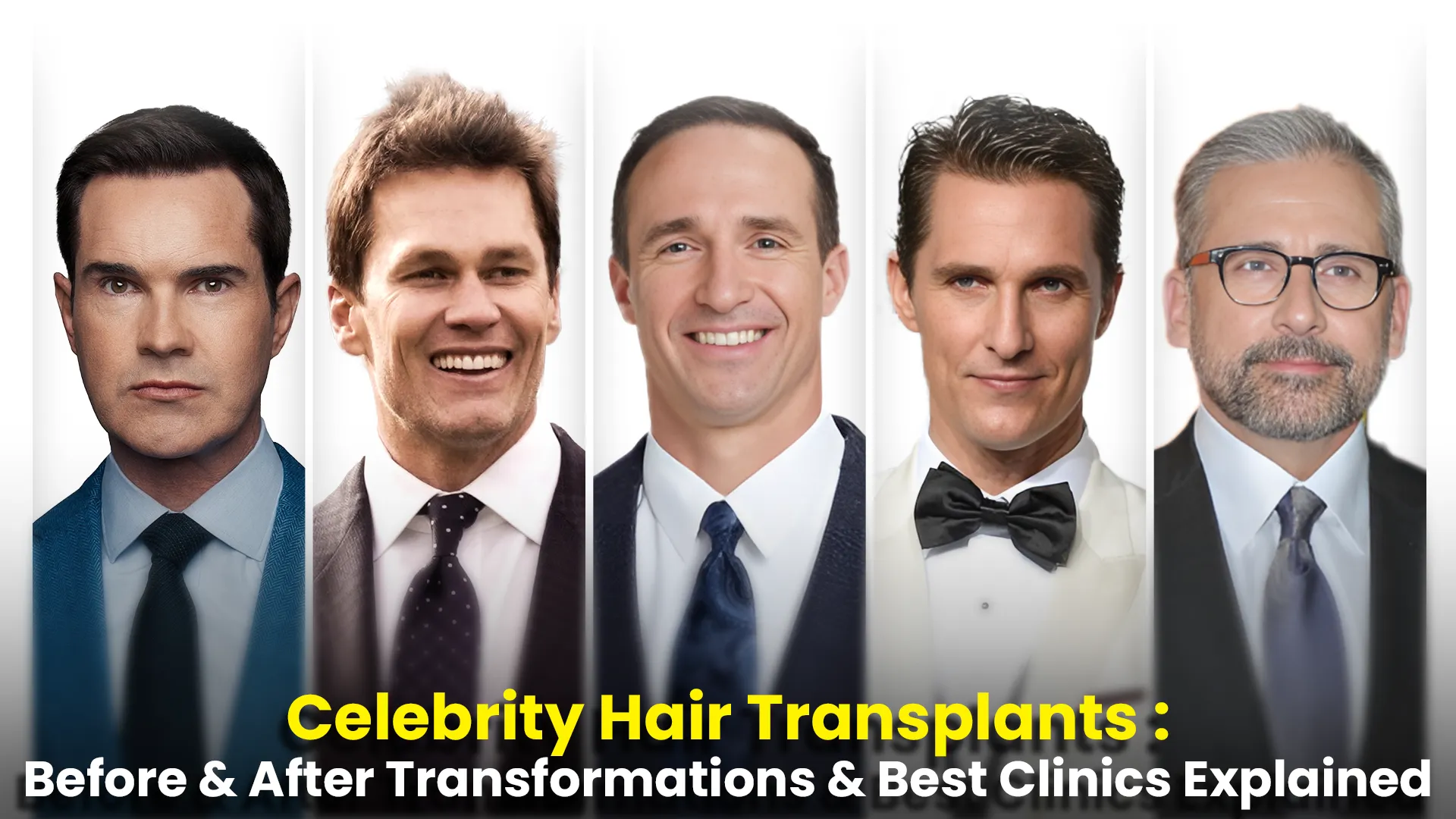 Celebrity Hair Transplants detailed guilde
