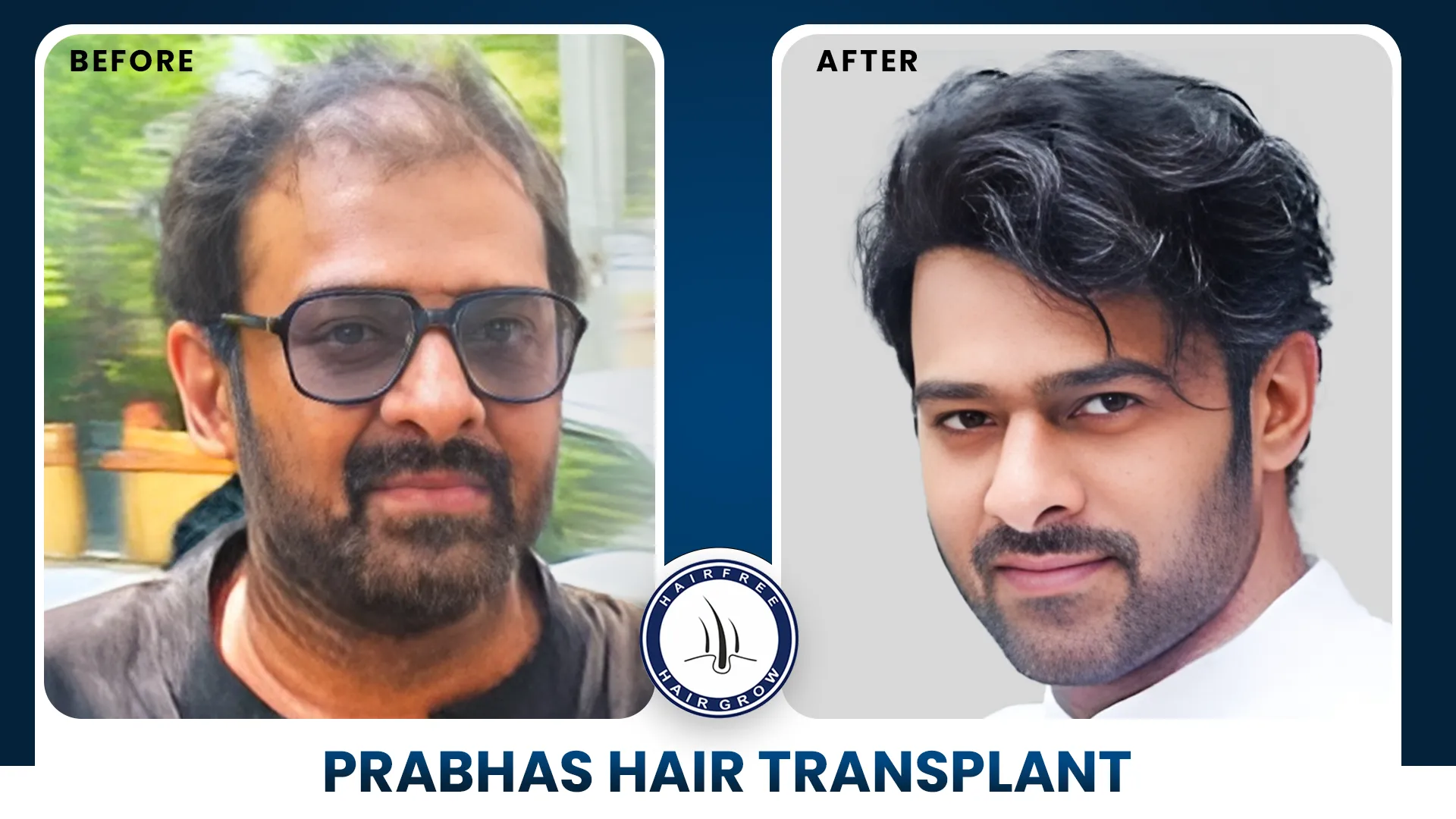 Transformation from thinning to fuller hair.