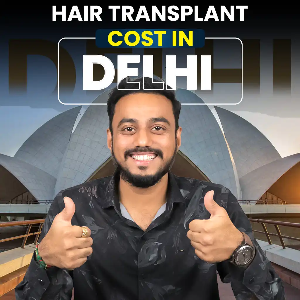 hair transplant cost in delhi detailed
