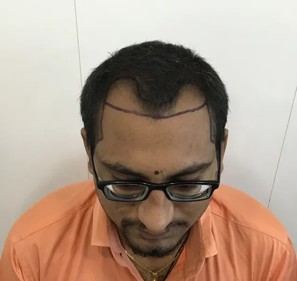 Man with short black hair