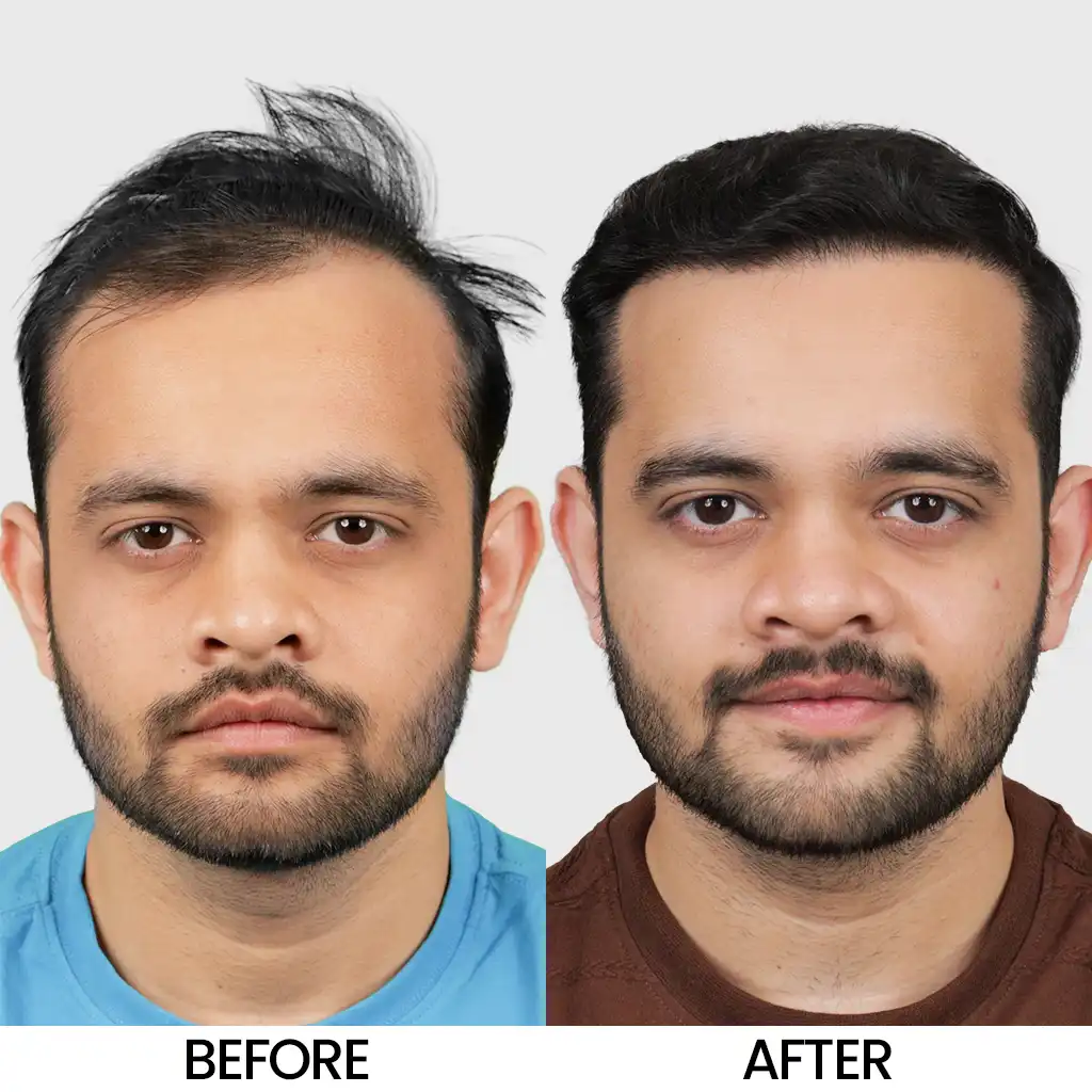 Hair transformation before and after