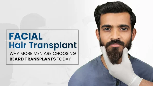 Facial Hair Transplant results showing improved beard growth