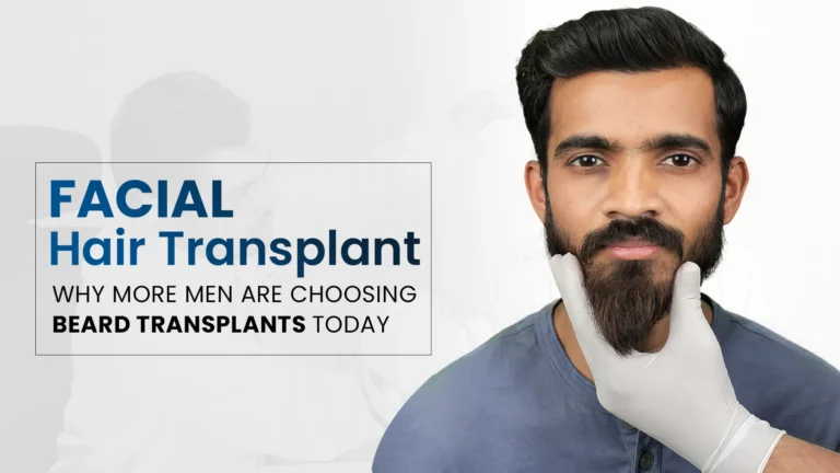 Facial Hair Transplant results showing improved beard growth