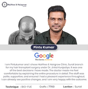 Hair Specialist Doctor in Surat before and after hair transplant results of patient Pintu Kumar with a restored hairline and thicker hair.