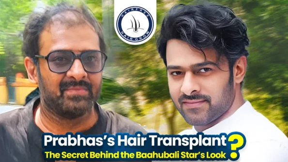 prabhas hair transplant guide and transformation details