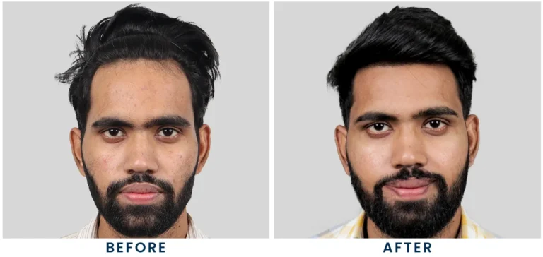 Recovery Maintenance change to thum 768x364 1