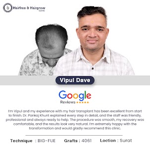 Hair Specialist Doctor in Surat before and after hair transplant results of patient Vipul Dave showing successful hair restoration and natural-looking results.