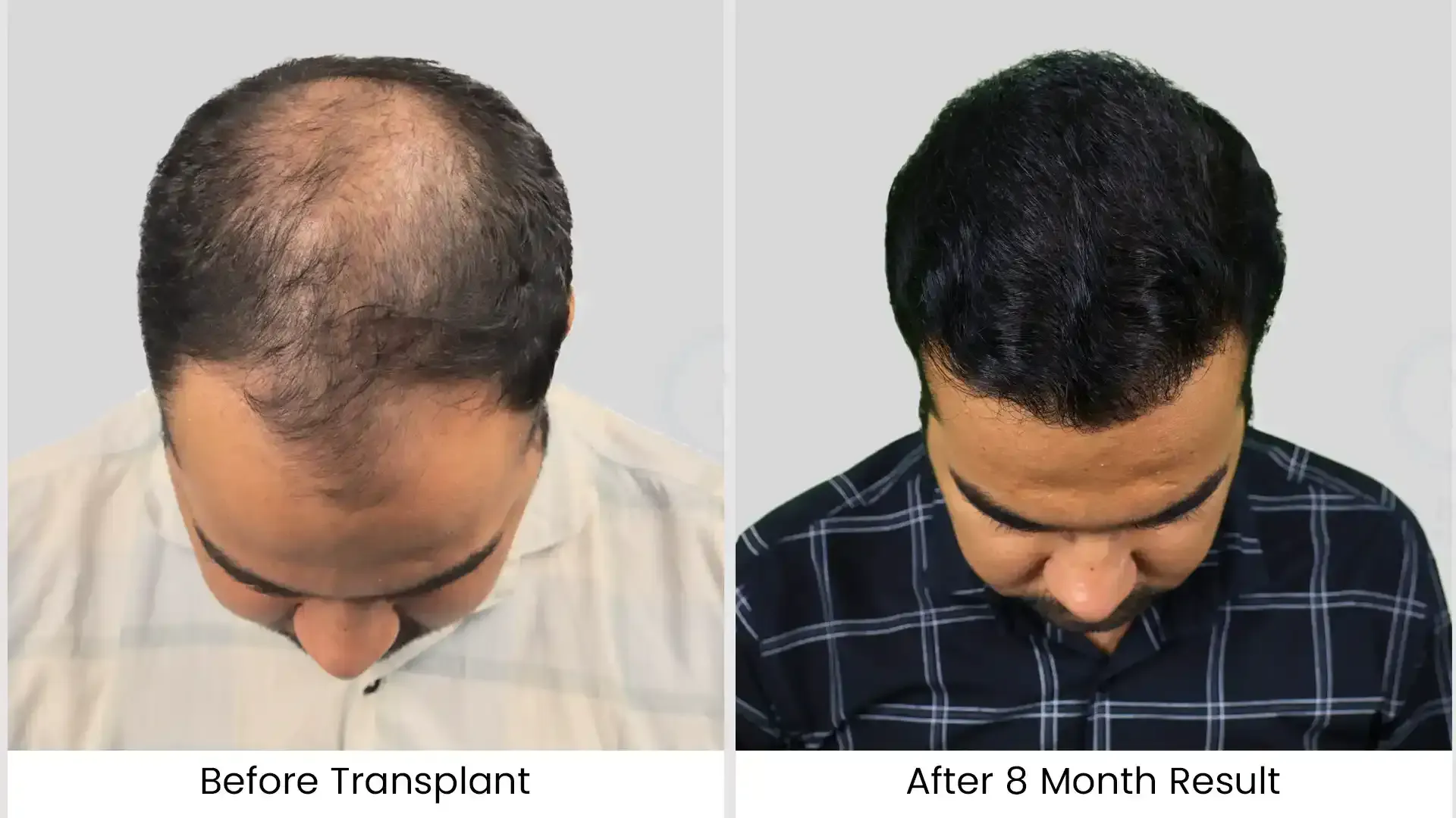 before after image - 1