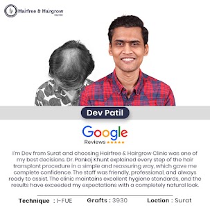 Hair Specialist Doctor in Surat before and after hair transplant results of patient Dev Patil showing natural hair growth and improved hair density.