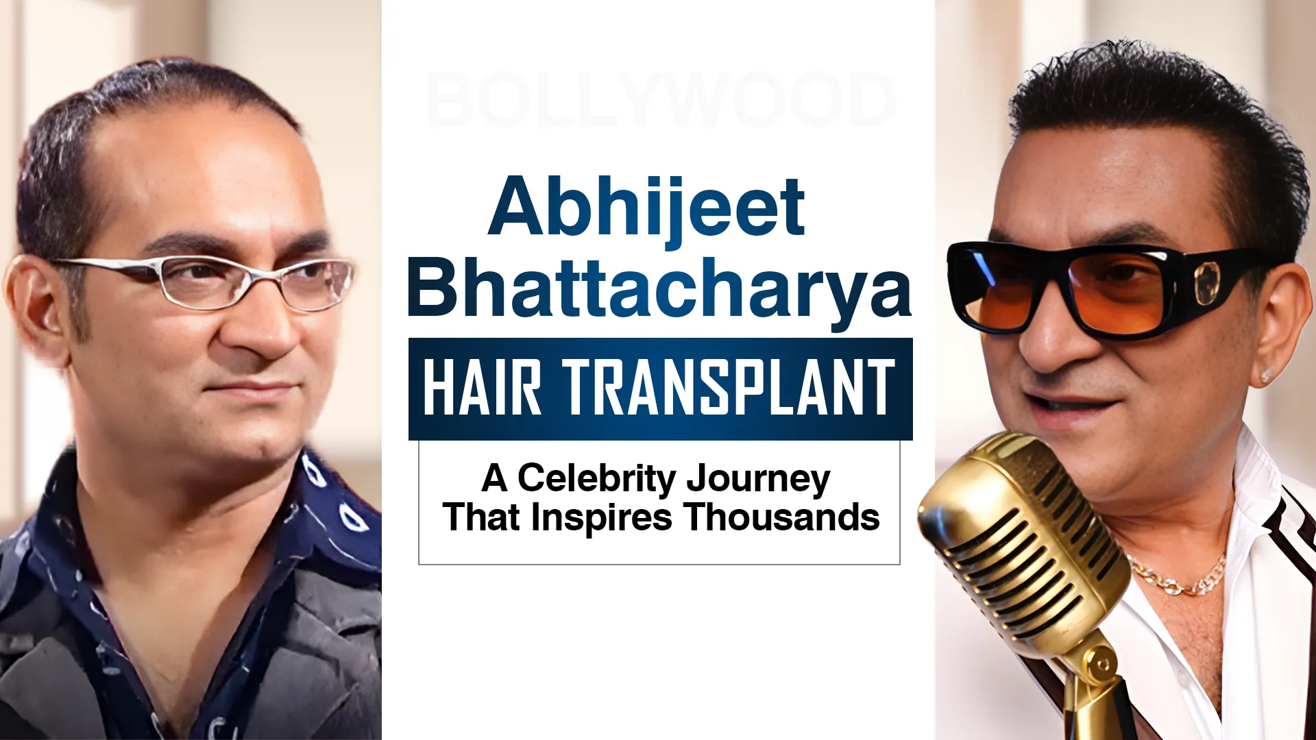 Abhijeet Bhattacharya Hair Transplant concept illustration with before-after visuals