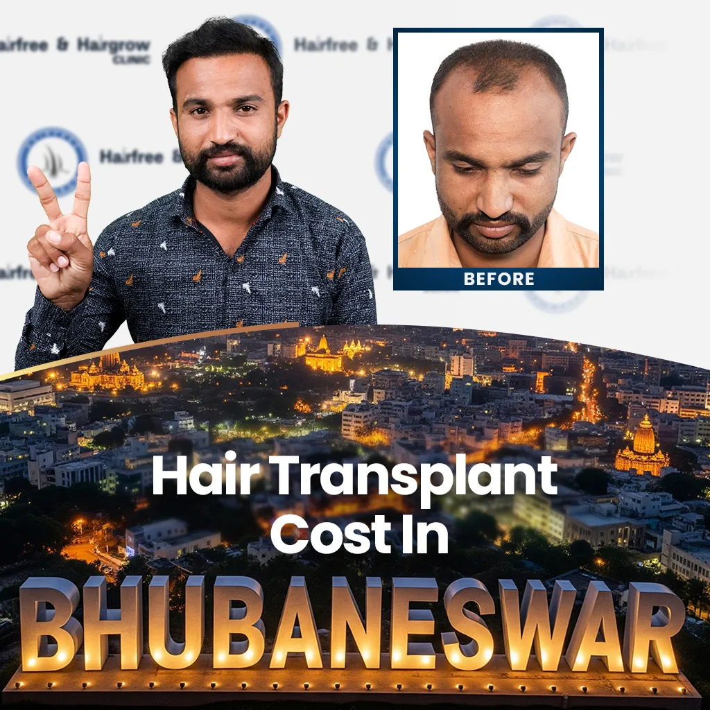 Hair transplant promotion in Bhubaneswar