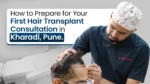 Hair Transplant Consultation