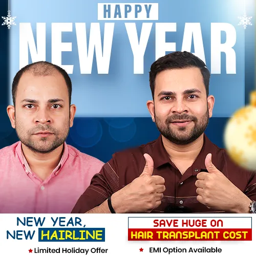 Global Leaders in Hair Transplant in India Since 2012