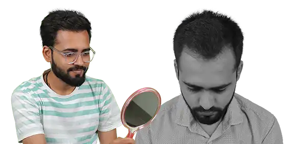 Hair Transplant Cost in Baroda patient review with before and after results