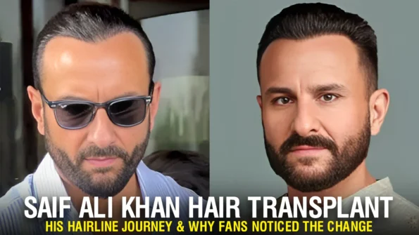 Saif Ali Khan Hair Transplant before and after hairline comparison image