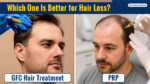GFC Hair Treatment vs PRP for hair loss, comparing two hair restoration treatments and their benefits for hair growth.