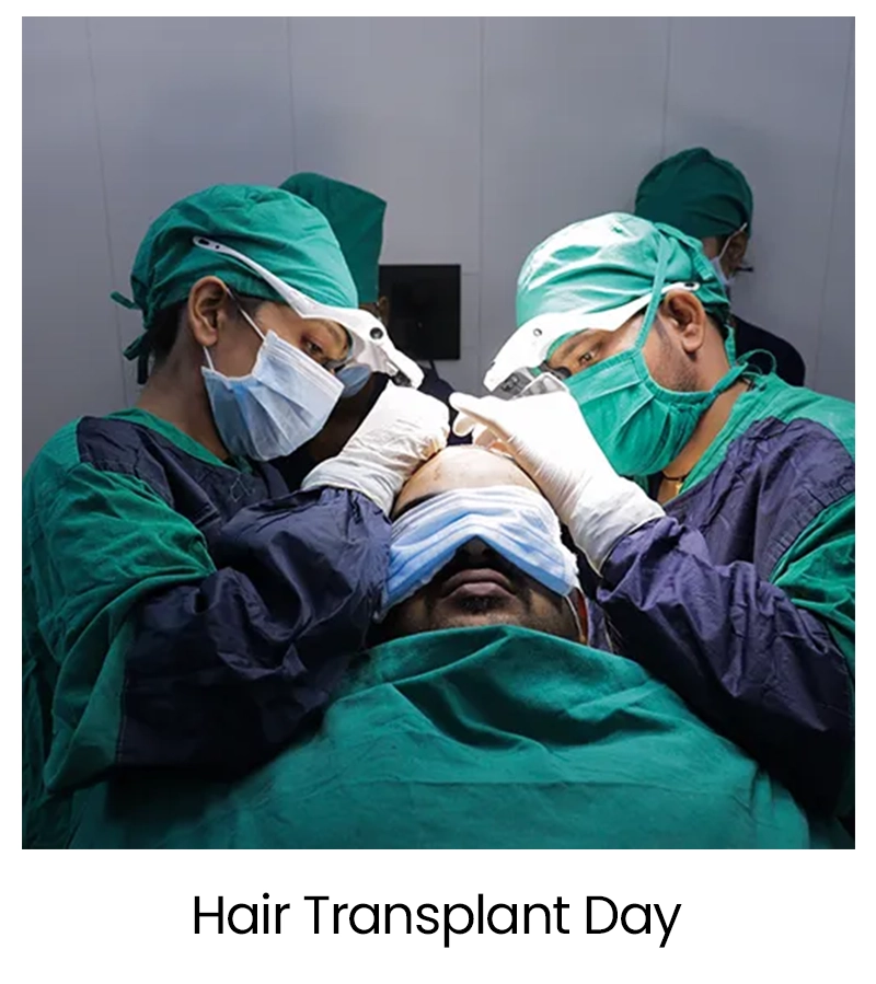 Medical Tourism for Hair Transplant in India 38 Hair Transplant Day