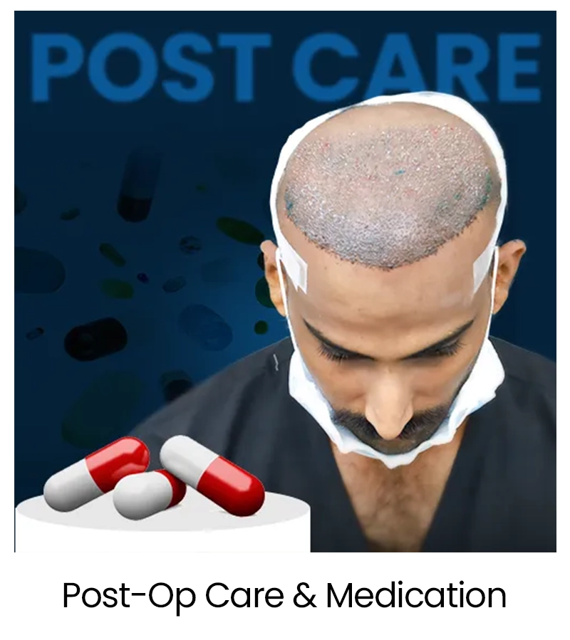 Medical Tourism for Hair Transplant in India 39 Post-Op Care & Medication