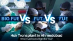 BIG FUE vs FUT vs FUE hair transplant techniques in Ahmedabad