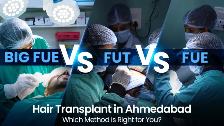BIG FUE vs FUT vs FUE hair transplant techniques in Ahmedabad