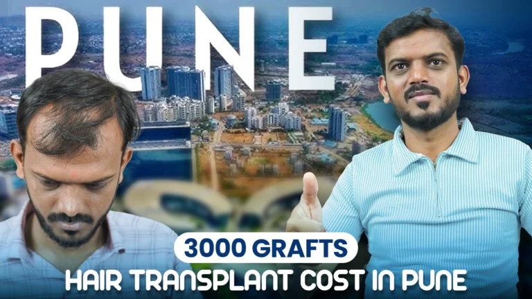 3000 grafts hair transplant cost in Pune