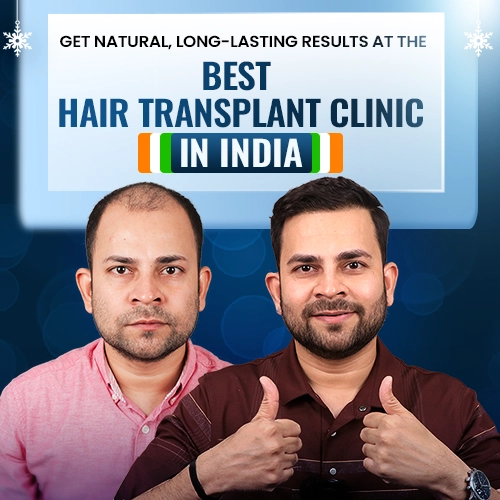 Global Leaders in Hair Transplant in India Since 2012