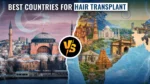 Best countries for hair transplant comparison between India and Turkey for cost, quality, and medical tourism