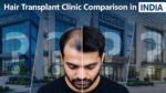 Hair Transplant Clinic Comparison India comparing cost, surgeon expertise, technology, and treatment results