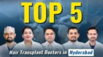 Best hair transplant doctors in Hyderabad for advanced hair restoration and natural-looking results