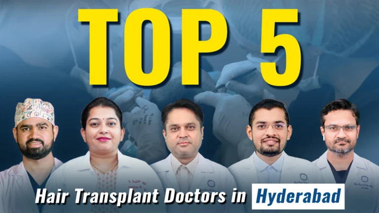 Best hair transplant doctors in Hyderabad for advanced hair restoration and natural-looking results