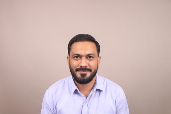 Grade 3 Baldness Hair Transplant 5 Months Recovery