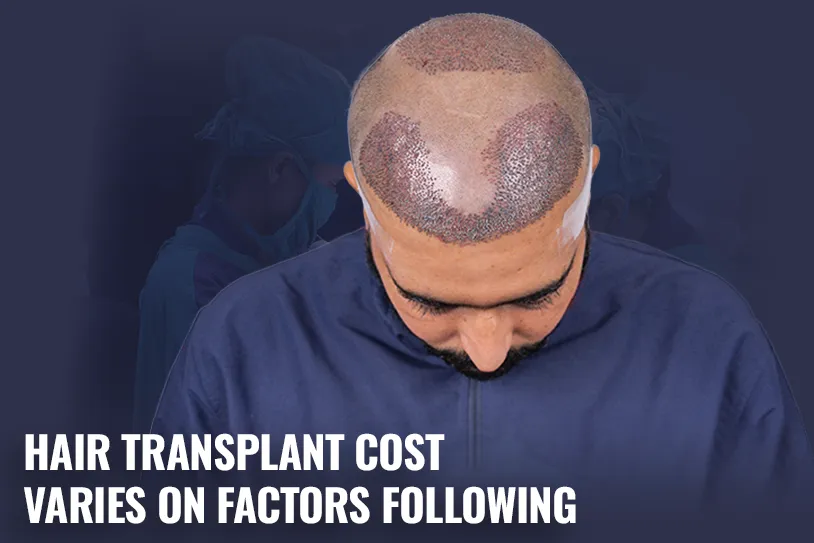 Hair Transplant Cost Varies on Factors Following