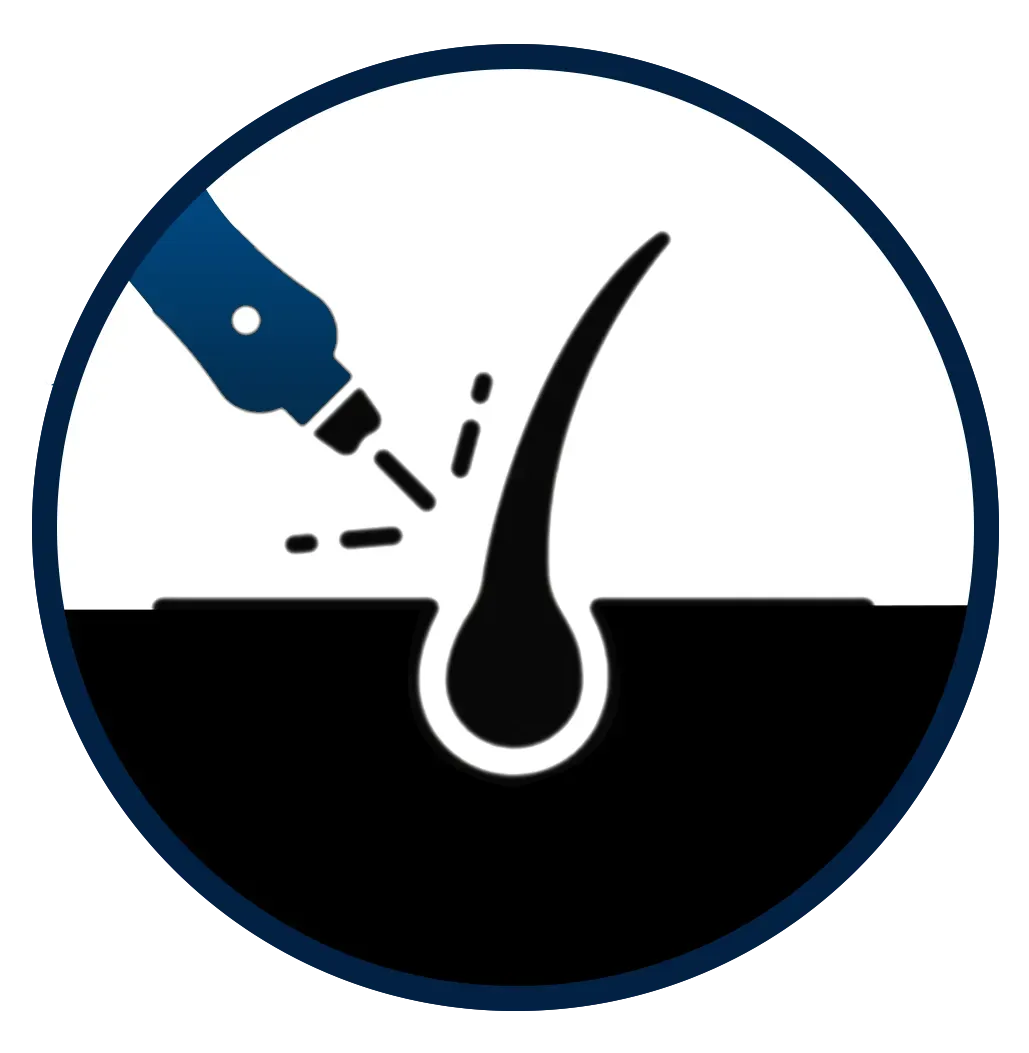 Advanced Sapphire FUE hair transplant technology