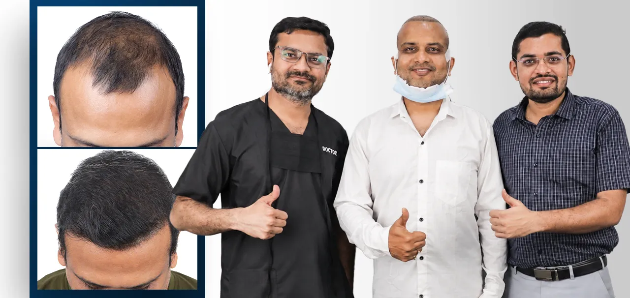 Hair transplant patient testimonial with doctor in Surat