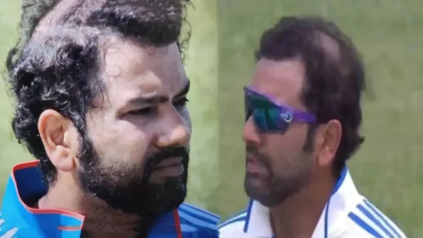 Rohit Sharma hair loss crown thinning mid career