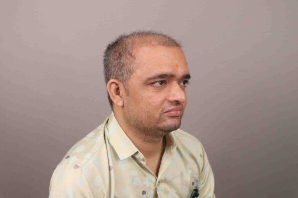 Hair Transplant Growth Chart infographic showing Month 2 after a hair transplant with minimal visible growth as transplanted hair follicles prepare for new hair growth.