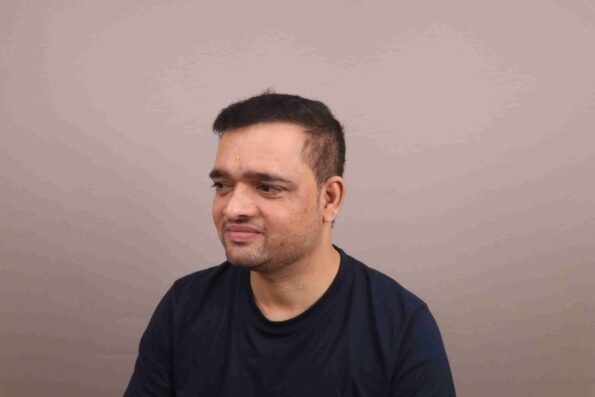 Hair Transplant Growth Chart infographic showing Month 6 with significant hair growth, improved hairline definition, and noticeable density.