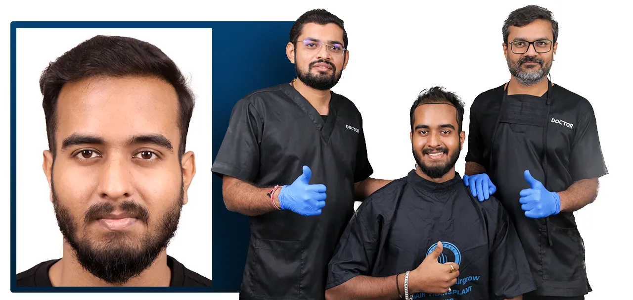 Hair Transplant in Silvassa patient review by Aman Kumar sharing his Bio-FUE hair transplant experience at HairFree HairGrow.