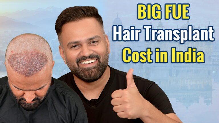 BIG FUE hair transplant cost in India with 2026 pricing and graft-based cost details.