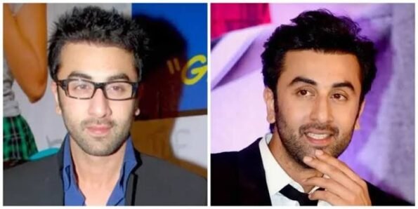 Celebrity hairline before and after comparison showing differences in frontal hairline appearance and hair density across public appearances.