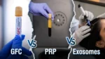 GFC vs PRP vs Exosomes comparison showing three advanced hair treatments for hair loss and hair growth.