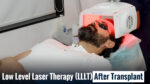 Low Level Laser Therapy (LLLT) after hair transplant treatment to support hair growth and recovery